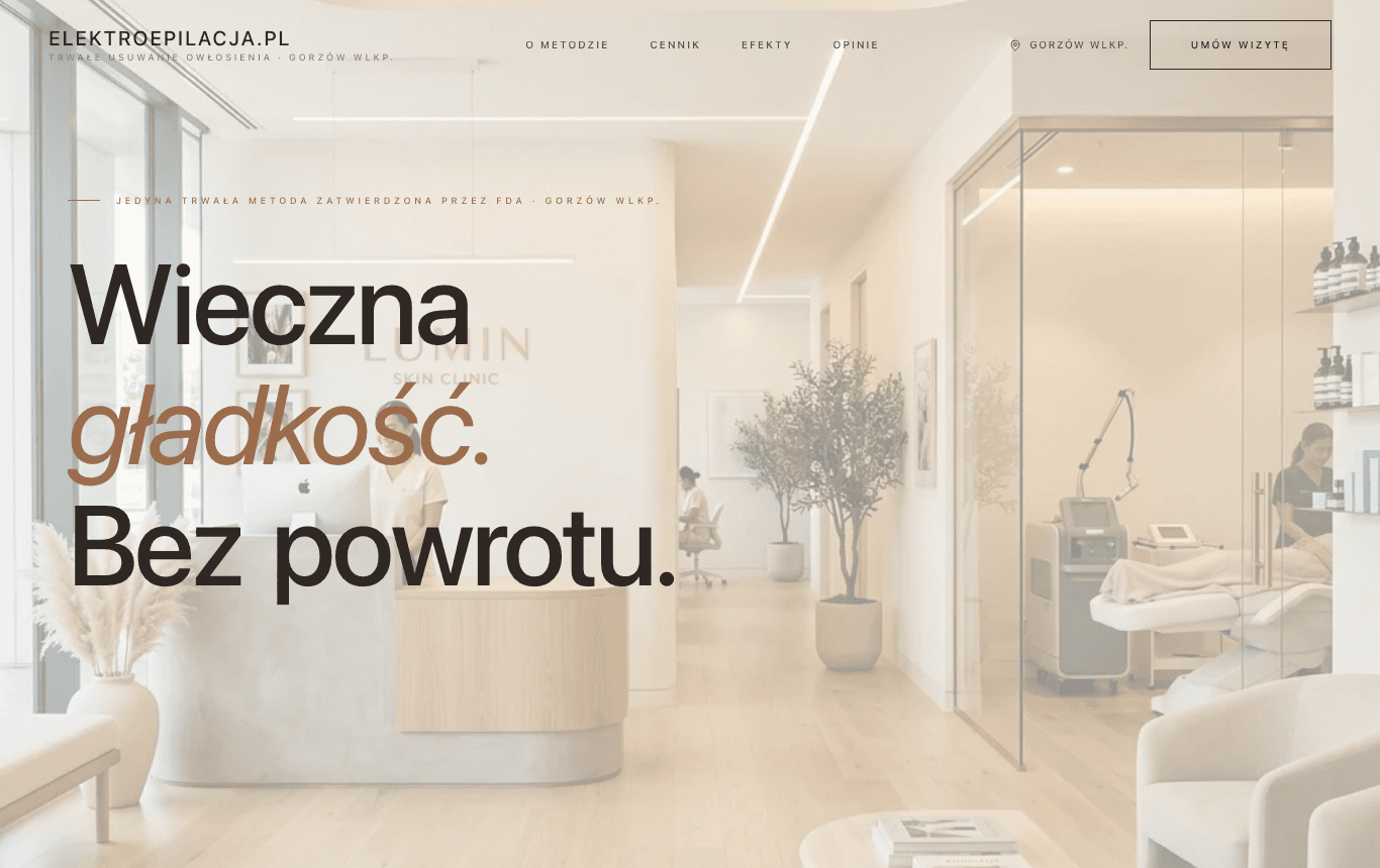Elektroepilacja